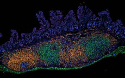 The Invisible Universe of the Human Microbiome