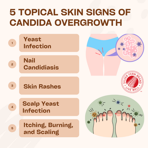 5 topical skin signs of candida overgrowth - gut health, pathogens, Nano Gel