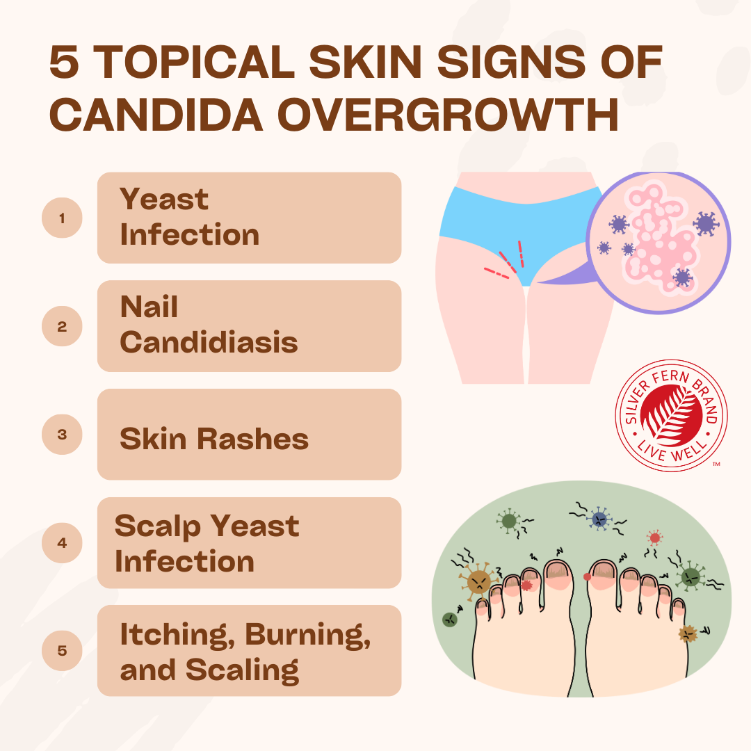 Candidal Body Rash Candidiasis Skin Symptoms